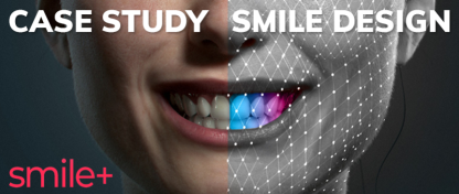 SMILE DESIGN