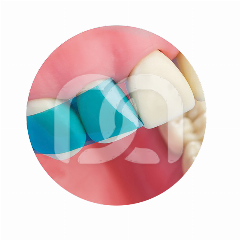 VARISTRIP BLUE VIEW - ANTERIOR MATRICES (50) VARISTRIP BLUE VIEW - ANTERIOR MATRICES (50)