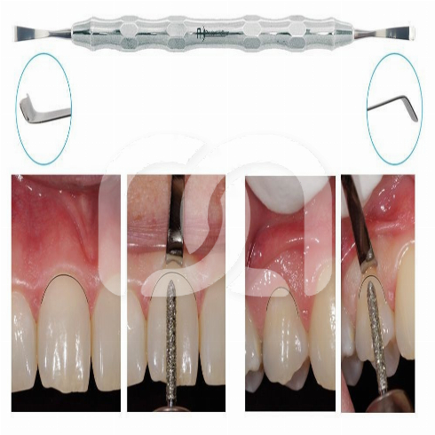 INSTRUMENT DOUBLE GINGIPROTECT 3,7MM INSTRUMENT DOUBLE GINGIPROTECT 3,7MM