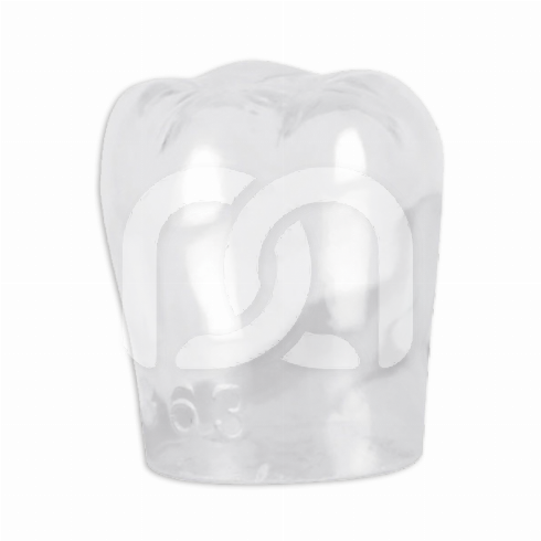 TRANSPARANTE TIJDELIJKE KRONEN (5) TRANSPARANTE TIJDELIJKE KRONEN (5)