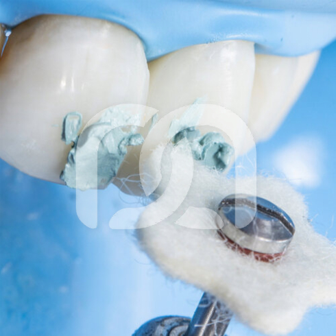 LUCIDA COMPOSITE GLOSS SYSTEM INTRO KIT LUCIDA COMPOSITE GLOSS SYSTEM INTRO KIT