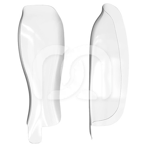 HD MATRIX - DIASTEMA CLOSURE (25)