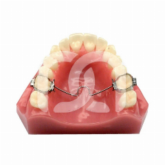 Arc Transpalatin Mésial pour Molaires (1)
